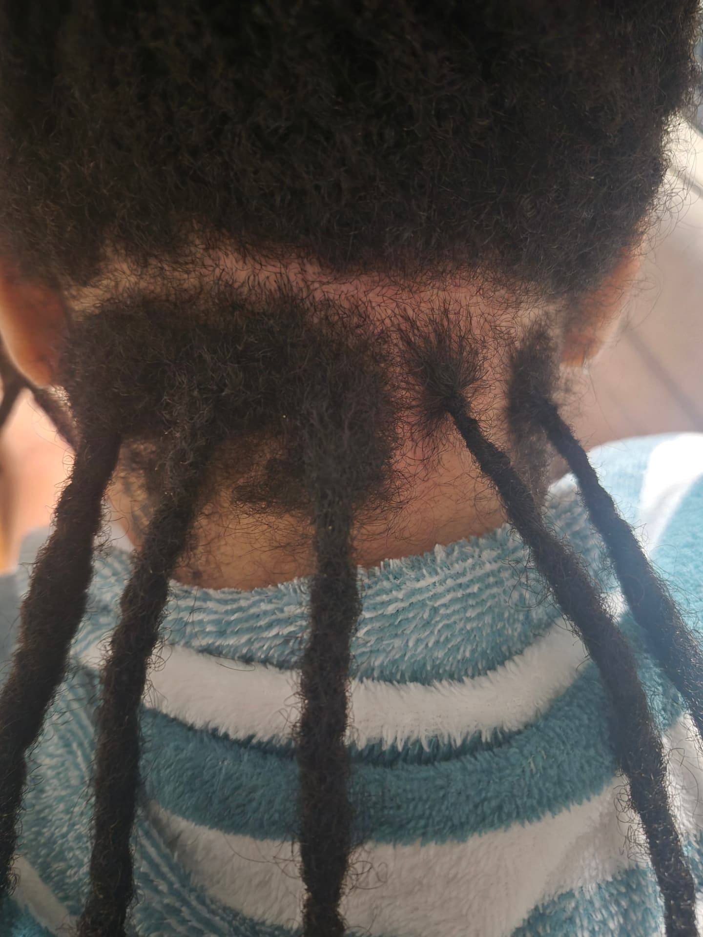 Freshly parted loc roots